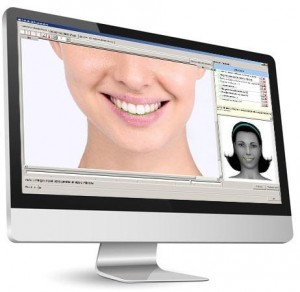 software estetica dentale