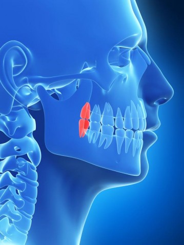 estrazione denti del giudizio Padova Treviso